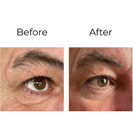 LUX001 - Peptilux – Anti-Falten Augencreme „Shock Action & Quot-Effekt mit Liphasyn™ - 20ml